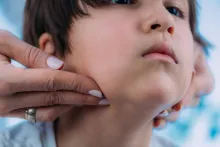 Salto sigue reportando más casos de  parotiditis infecciosa de todo el país 