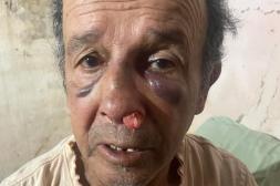 Sindicato de cuidacoches exige medidas  tras violenta agresión a un trabajador