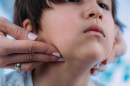 Salto sigue reportando más casos de  parotiditis infecciosa de todo el país 